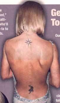 Back